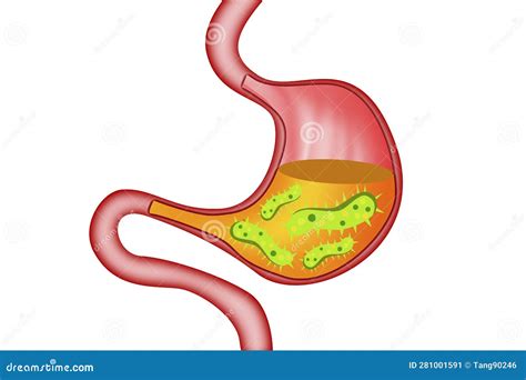 Virus And Bacteria Inside Human Stomach Stock Illustration