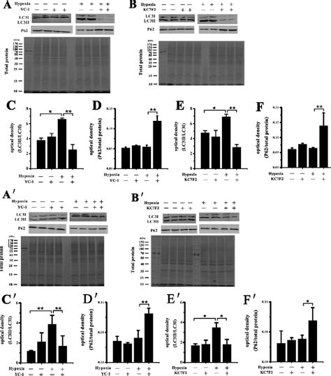 Figure 1 from HIF 1α contributes to hypoxia adaptation of the naked mole rat Semantic Scholar