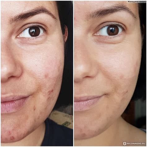 Гиалуроновая тональная сыворотка L Oreal Paris Alliance Perfect Nude