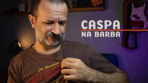 Como Acabar Com A Caspa Na Barba - Como Acabar de Vez com a Caspa na Barba - YouTube