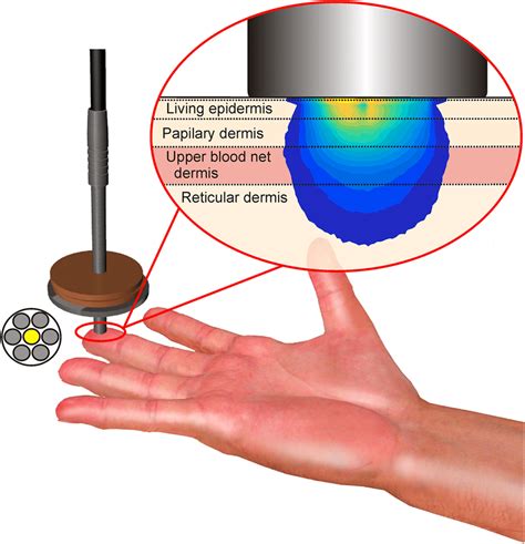 Schematics Of The Setup Used For Pressure Affected Skin Reflectance