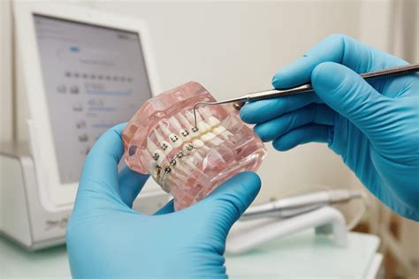 Myths And Misconceptions About Orthodontics Treatments