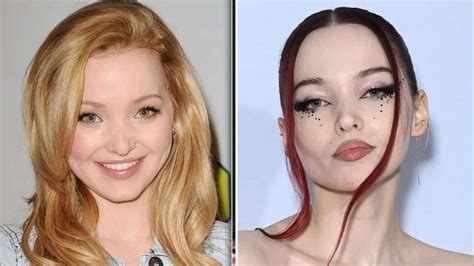 Dove Cameron Before And After Plastic Surgery Journey