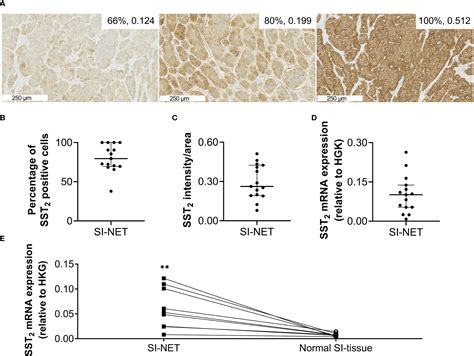 Frontiers Epigenetic Regulation Of Sst Expression In Small