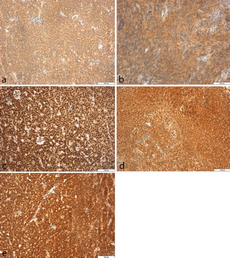 Representative Images From Immunohistochemical Staining Expression Of