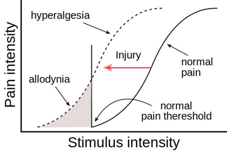 Hyperalgesia - Physiopedia