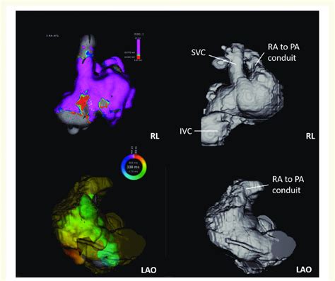 Example Of A 3d Reconstruction From Cardiac Magnetic Resonance Imaging