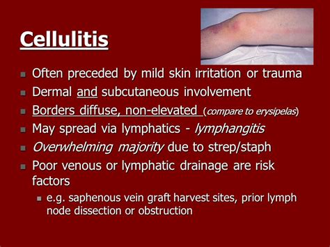 Strep Vs Staph Cellulitis