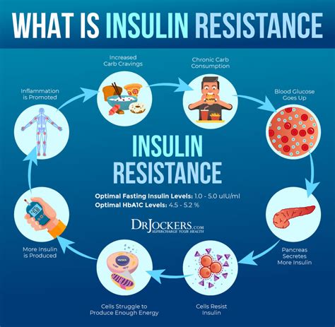 Are You Insulin Sensitive Or Insulin Resistance Debbie Potts Coaching