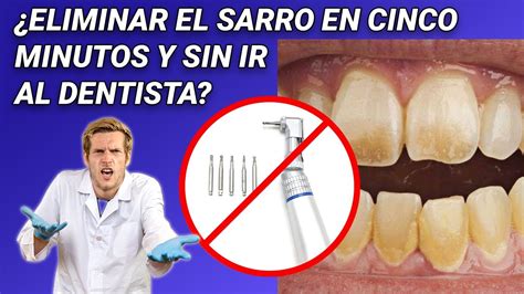 Cómo eliminar la placa bacteriana sin ir al dentista YouTube