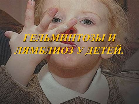 Гельминтозы и лямблиоз у детей - презентация онлайн