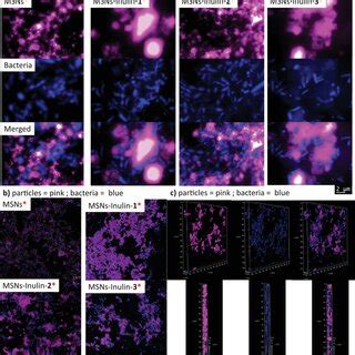 a) Structured illumination microscopy images obtained from the... | Download Scientific Diagram