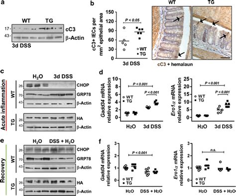 C Ebp Homologous Protein Chop Expression Is Regulated Independently