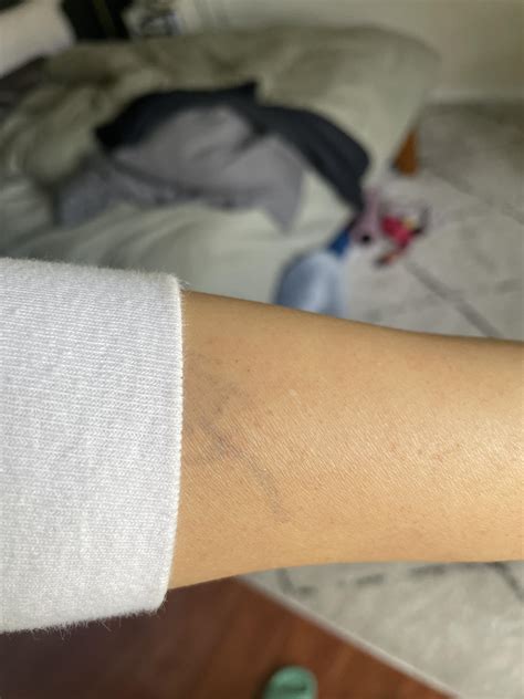 What is this small white bump? : r/DermatologyQuestions