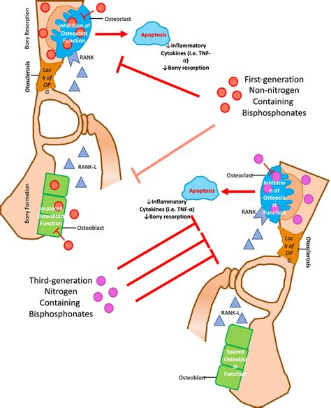 Schematic Diagram Of Bisphosphonate Function In Otosclerosis