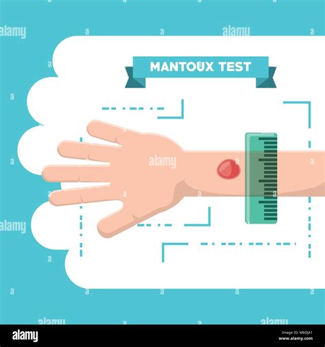 Mantoux Test Design With Hand And Injection Over Blue And White