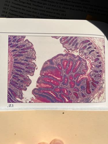 Unit 10 Carbohydrates And Amyloid Flashcards Quizlet