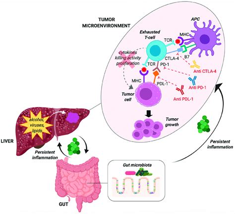 Mechanisms Of Immune System Paralysis In Patients With Hepatocellular