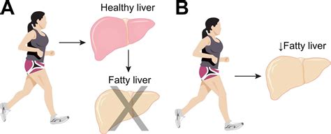 exercise good   liver  adrienne maldonado blog