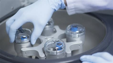 Understanding Platelet Rich Fibrin Prf And Its Application In Dentistry