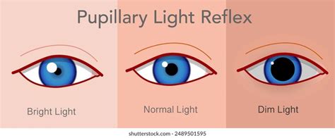 Pupil Reflex Over 120 Royalty Free Licensable Stock Illustrations