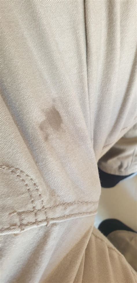 This Is What Happens When You Stroke Your Uncut Fatty And Dont Cum You Leak In Your Work