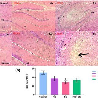 Photomicrographs of hippocampal tissue stained with H&E (a) H&E ...