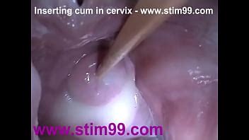 Semen De Inserci N Semen En El Cuello Uterino Esp Culo De Co O De Gran Estiramiento Xvideos