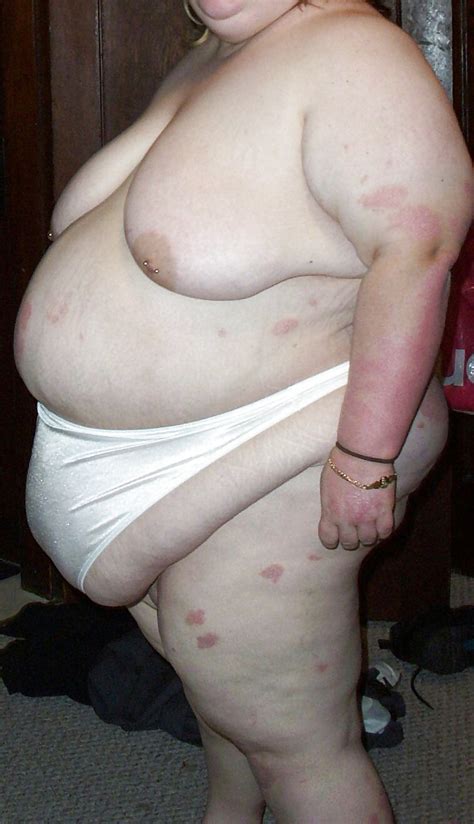 BBW Sexy Fat Pigs Part Porn Pictures XXX Photos Sex Images PICTOA