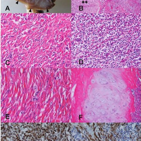 Macroscopic Histopatho Logic And Immunohistochemical Features Of The