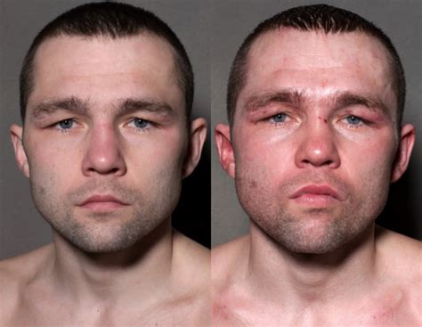 Photos Boxers Faces Before And After They Step Into The Ring