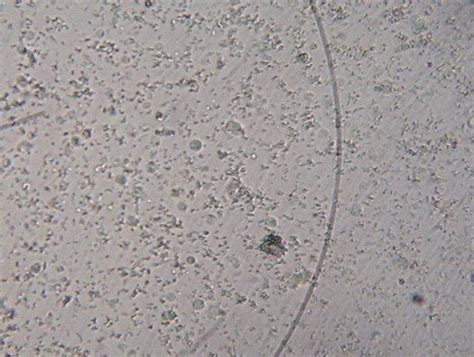 microphotograph  urinary sediment   years  male german shepherd