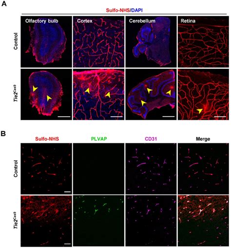 In Vivo Genome Editing Of The Ctnnb1 Gene Causes BBB Breakdown A