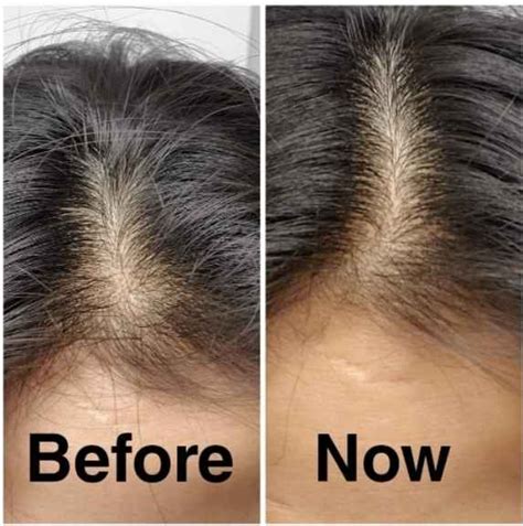 Does Hair Thickening Shampoo Work? What You Should Know... - Hair ...