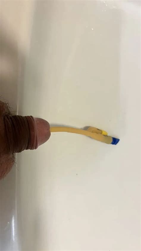 Catheter Nude Pics XHamster