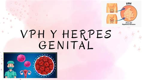 VPH Y Herpes Genital Antuanet LLacsahuanga UDocz