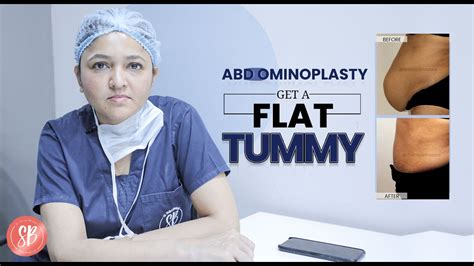 Abdominoplasty Tummy Tuck In Delhi And Gurgaon By Shilpi Bhadani