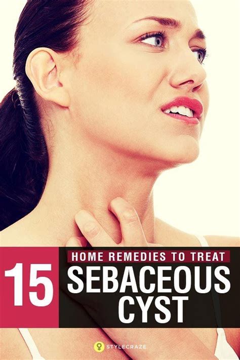 15 Effective Home Remedies To Treat Sebaceous Cyst Self Help