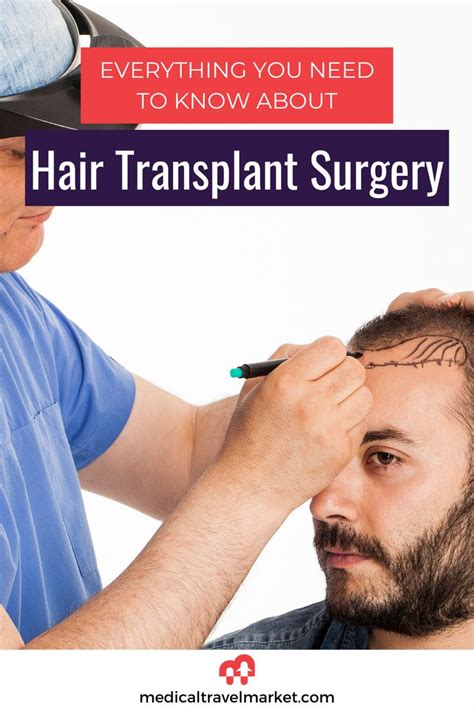 hair transplants female hair transplant hair transplant timeline
