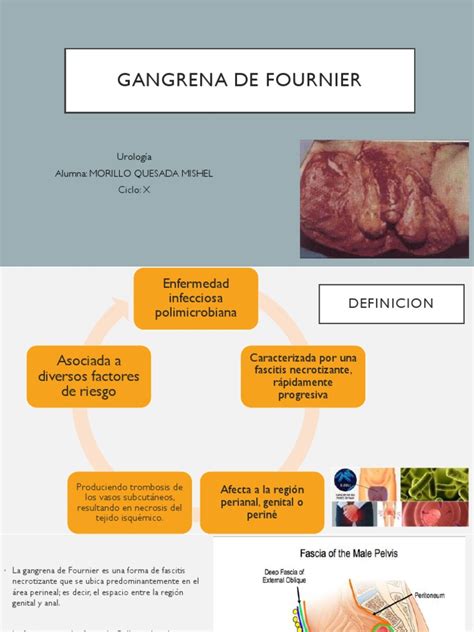 Fournier Enfermedad