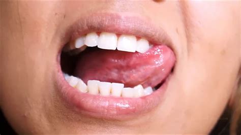 Mouth Close Up With Fillings 2 Youtube