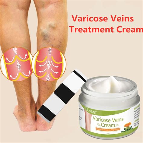 50g Varicose Veins Treatment Cream Varicosity Angiitis Remedy Ointment