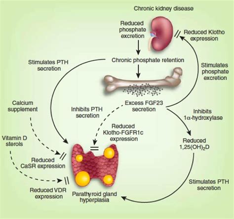 hyperparathyroidism  chronic kidney disease endotext ncbi bookshelf