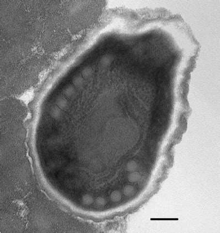 Mature Spore Showing Six Coils Of The Polar Tube Note That The Coils