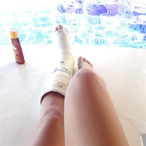 Bikini Leg Cast Porn Pictures XXX Photos Sex Images PICTOA