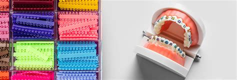 braces rubber bands  types  braces elastics work