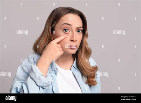 Woman with yellow eyes on grey background. Liver problems symptom Stock ...