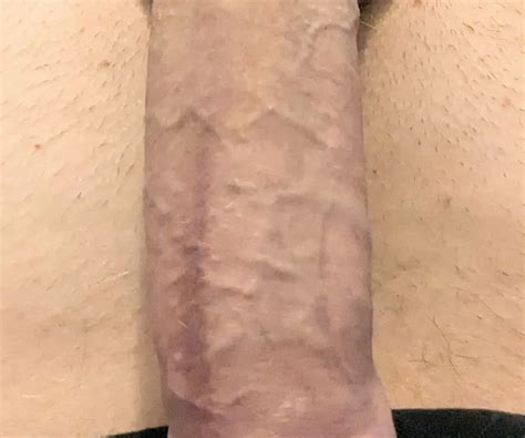 Thick Uncut Cd Cock Nude Pics Xhamster