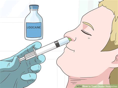 How to Treat Cluster Headaches: 12 Steps (with Pictures) - wikiHow