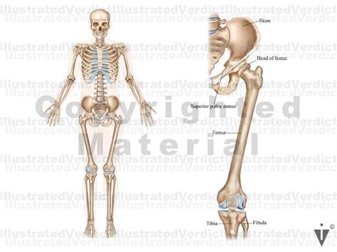 Stock Lower Limb Orthopedic Illustrated Verdict